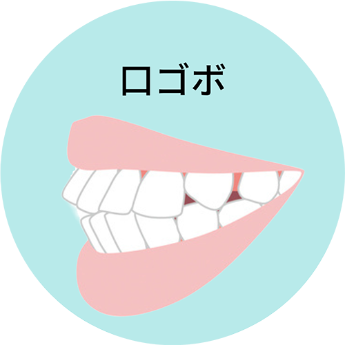 口ゴボ