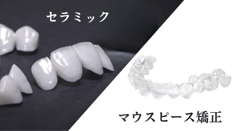 静岡県浜松市のスピード矯正