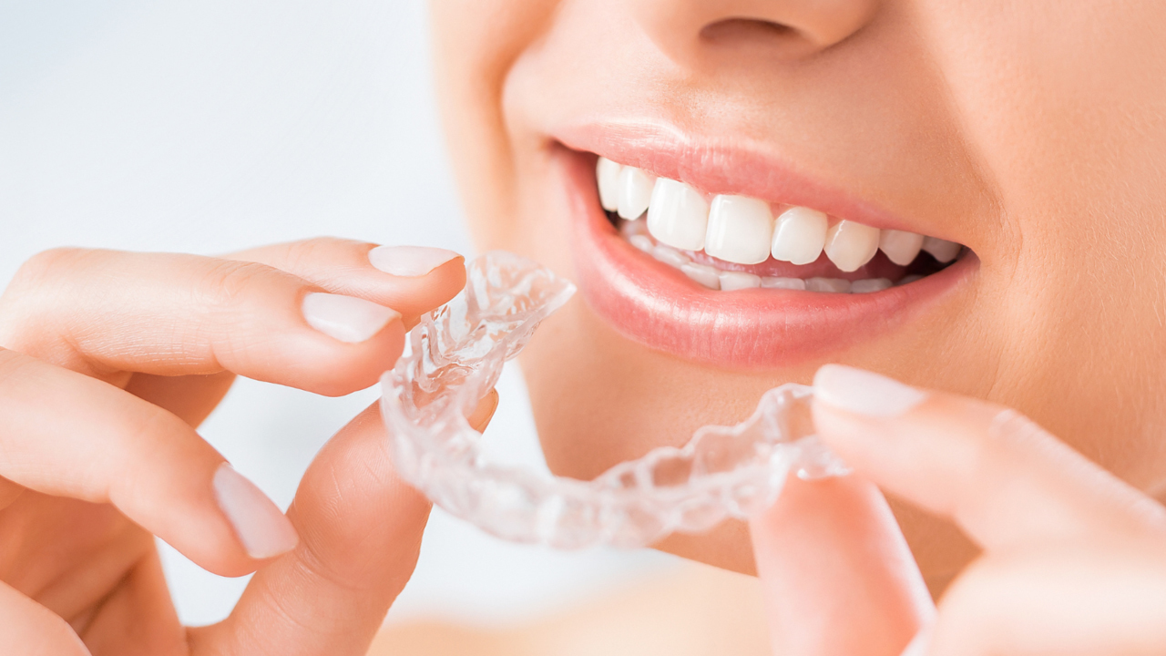 静岡県浜松市のいつでも取り外せる安いインビザライン