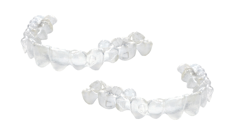 マウスピース矯正