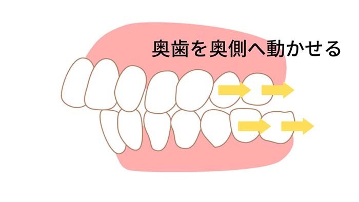 静岡県浜松市のインビザライン認定医