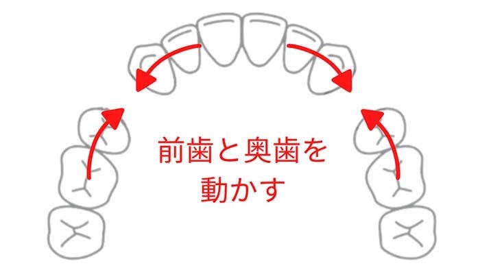 静岡県浜松市の後悔しない歯列矯正